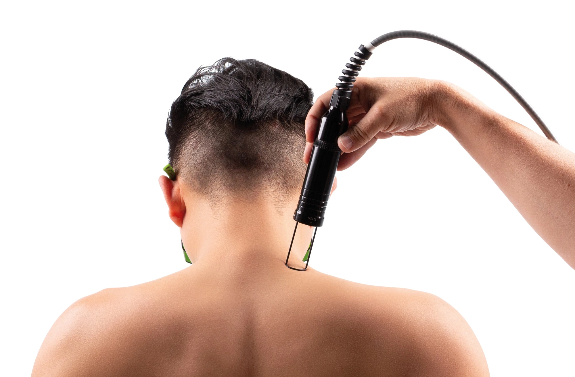 hiro_laser_cervical_area.webp